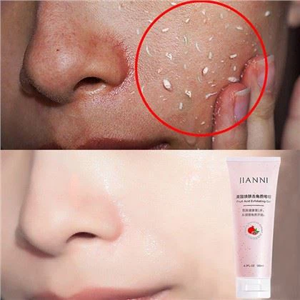 Piling gel s sadno kislino